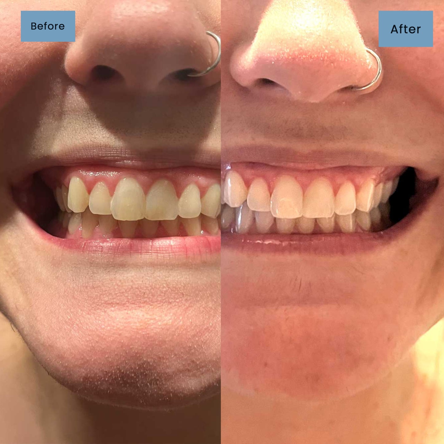 Niacinamide Whitening Toothpaste 2.0