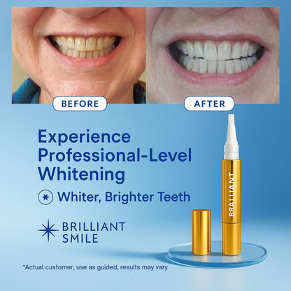 Extra-Strength Teeth Whitening Serum